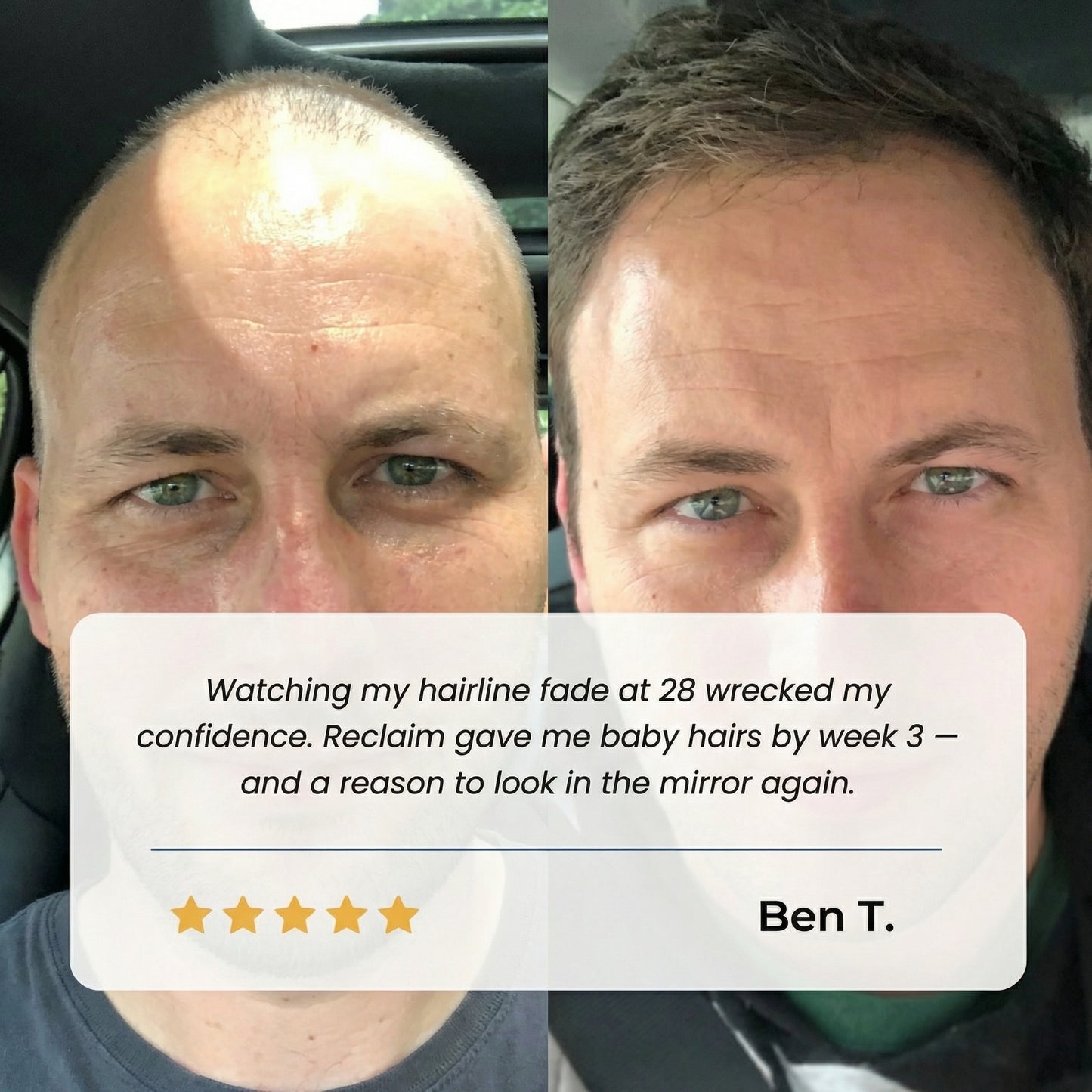 Civaroa Hair Growth Roll on Serum